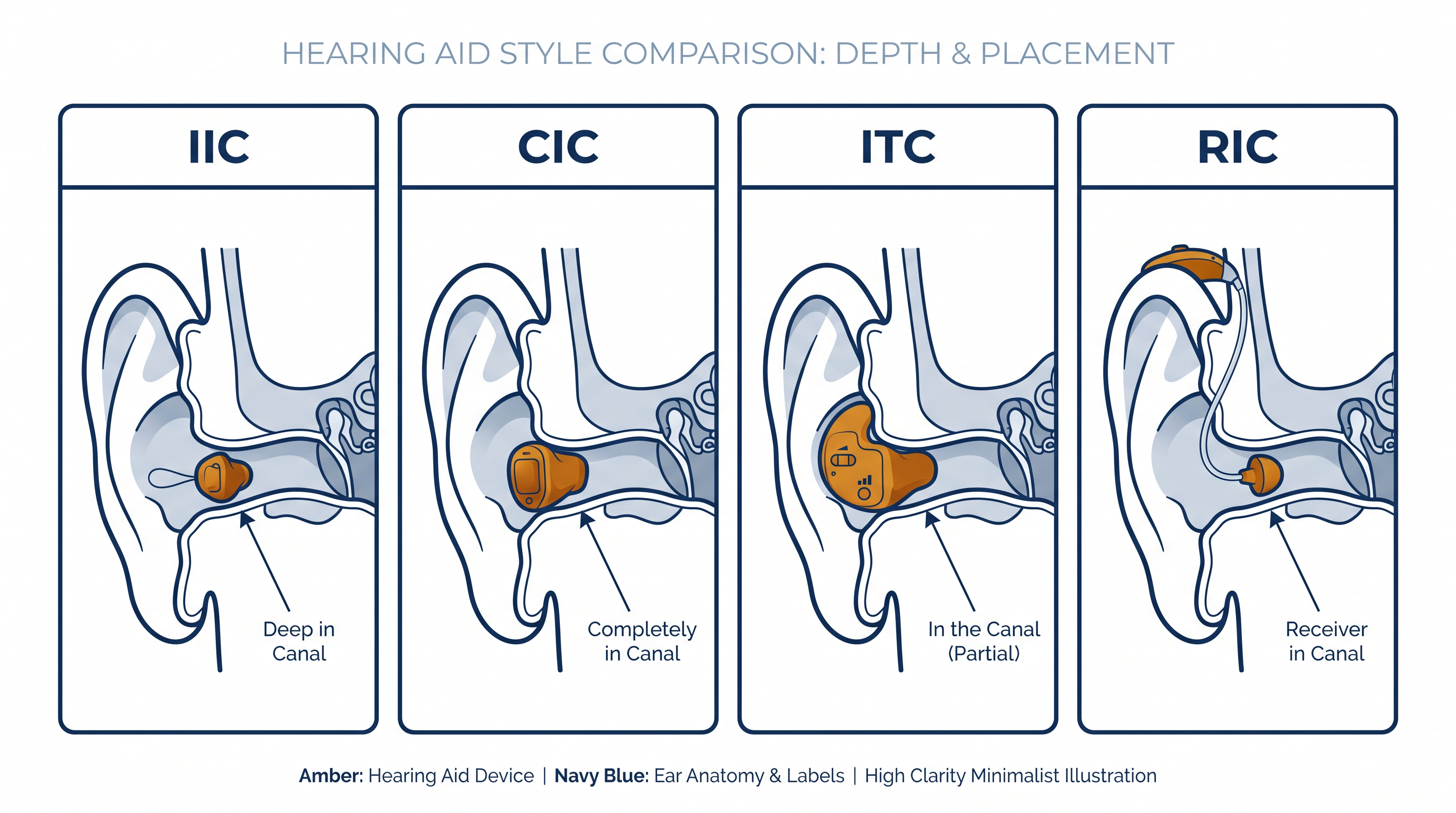 Schéma comparant les styles IIC, CIC, ITC et RIC dans l'oreille